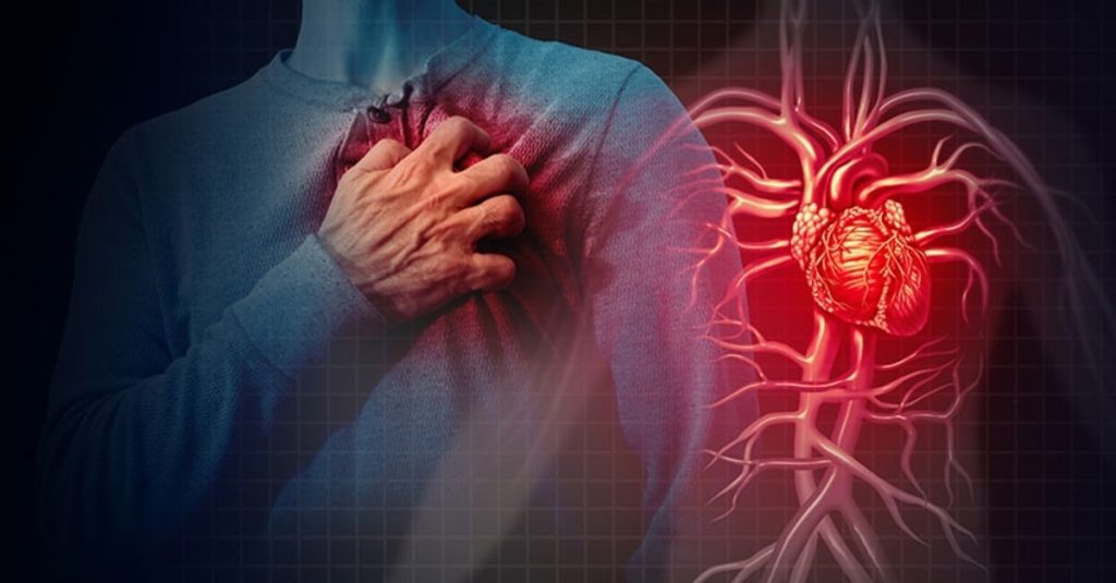 عوامل خطر سکته قلبی