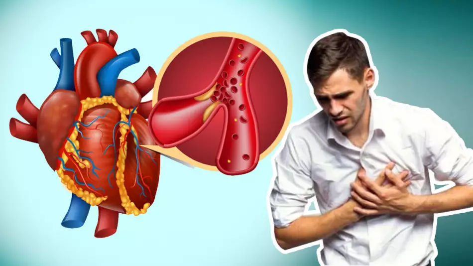 عوامل خطر سکته قلبی