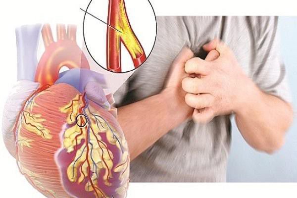 آیا آنژین قلبی خطرناک است 
