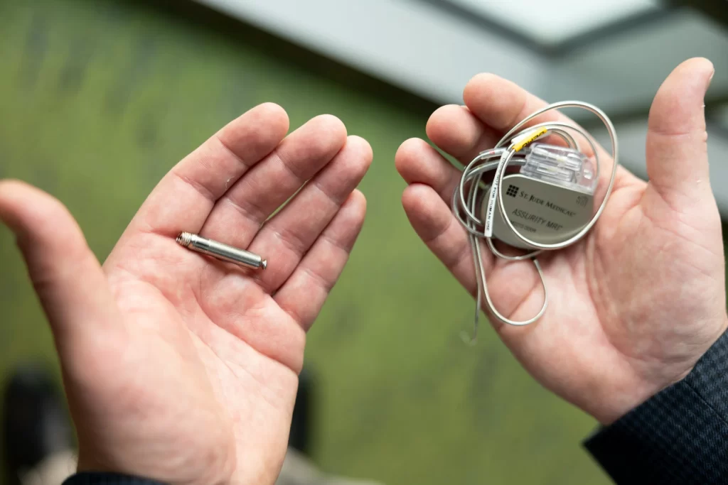 آریتمی قلبی