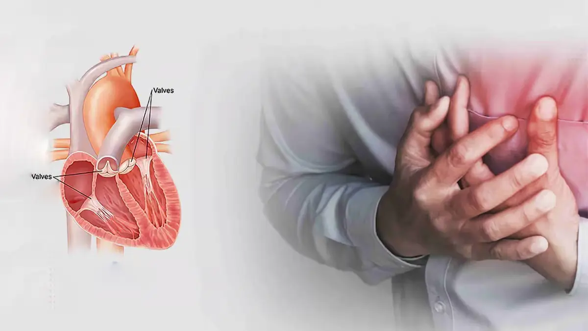 عوارض روماتیسم قلبی
